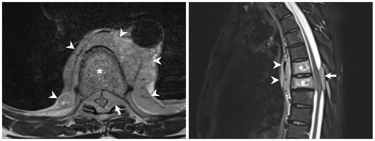 20200617_213017